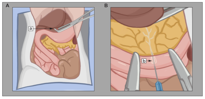 Surgical anatomy diagram, localization of abdominal structures with surgical tools for educational purpose.