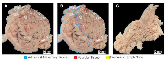 Adipose, vascular, and lymph node tissue dissection diagram; color-coded for tissue identification.