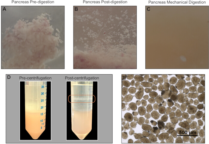 Pancreas cell isolation process; pre/post-digestion, centrifugation, microscopy; experimental study.