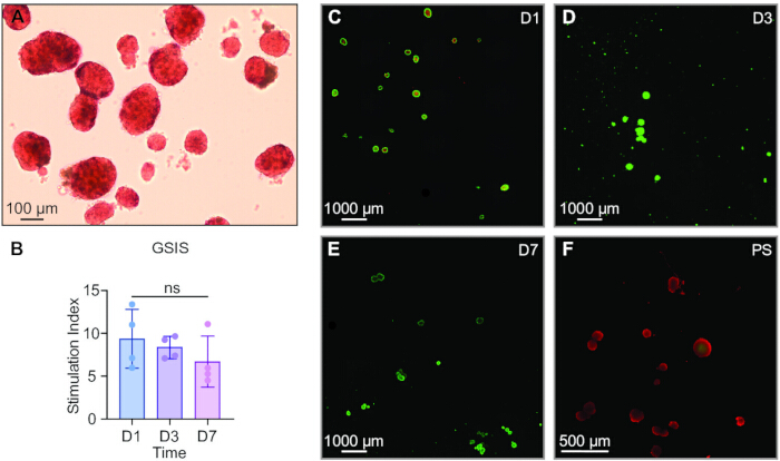 Cell morphology study; microscopy images; GSIS bar graph; fluorescent analysis D1-D7, PS assay results.