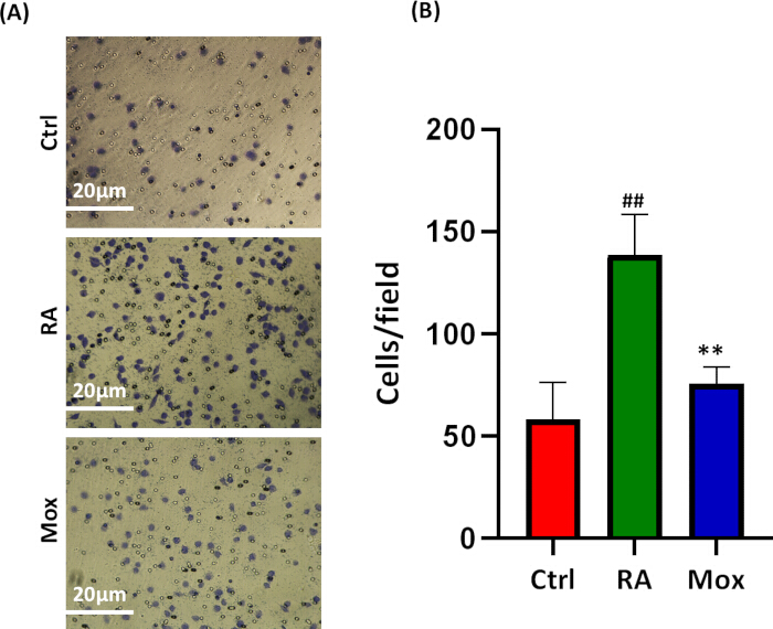 Cell growth comparison; microscopy images, bar graph analysis, cell density increase, Ctrl RA Mox.