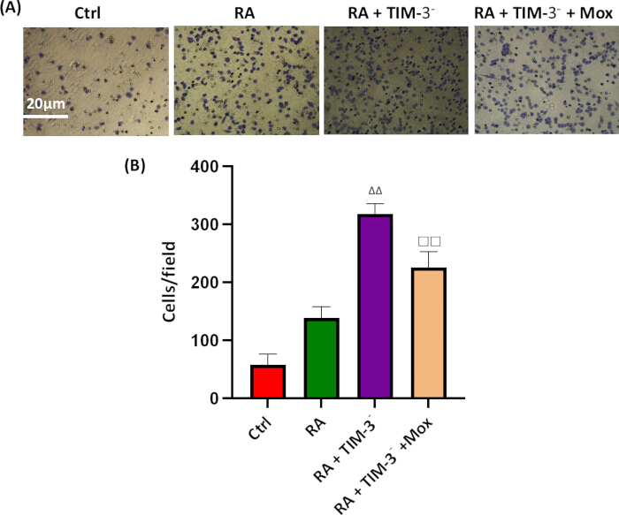 Cell migration assay, stained samples (20µm) and bar chart, comparing Ctrl, RA, TIM-3-, Mox.