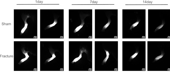 Bone healing comparison, fluorescence imaging, fracture vs. sham, time points: 1, 7, 14 days.