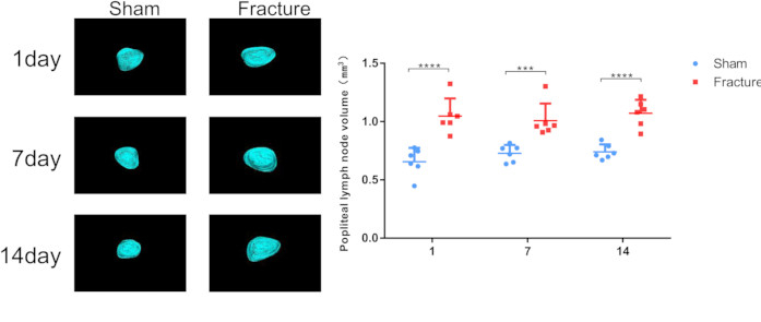 Popliteal lymph node MRI images, volume analysis chart; fracture vs sham, 1-14 days post-injury.