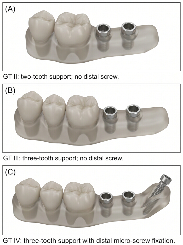 figure-protocol-5 牙科修复体支持形式的变化;带螺钉的模型比较;种植体研究示意图。