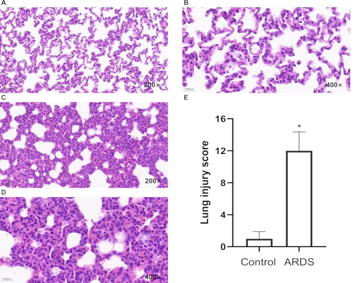 Lung tissue histology, ARDS vs Control, light microscopy and injury score bar chart analysis.