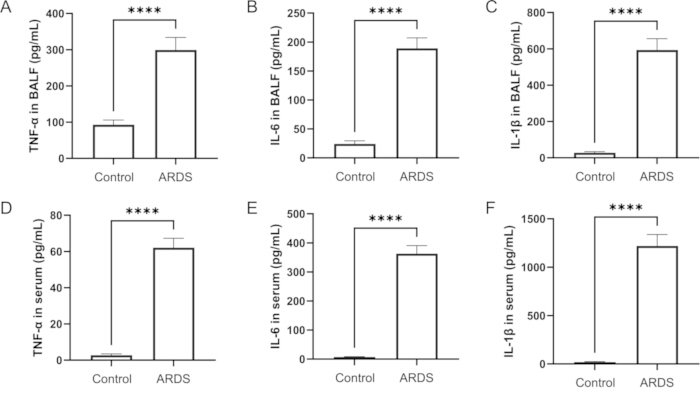 Bar graphs comparing cytokine levels (TNF-α, IL-6, IL-1β) in BALF/serum for ARDS vs control.
