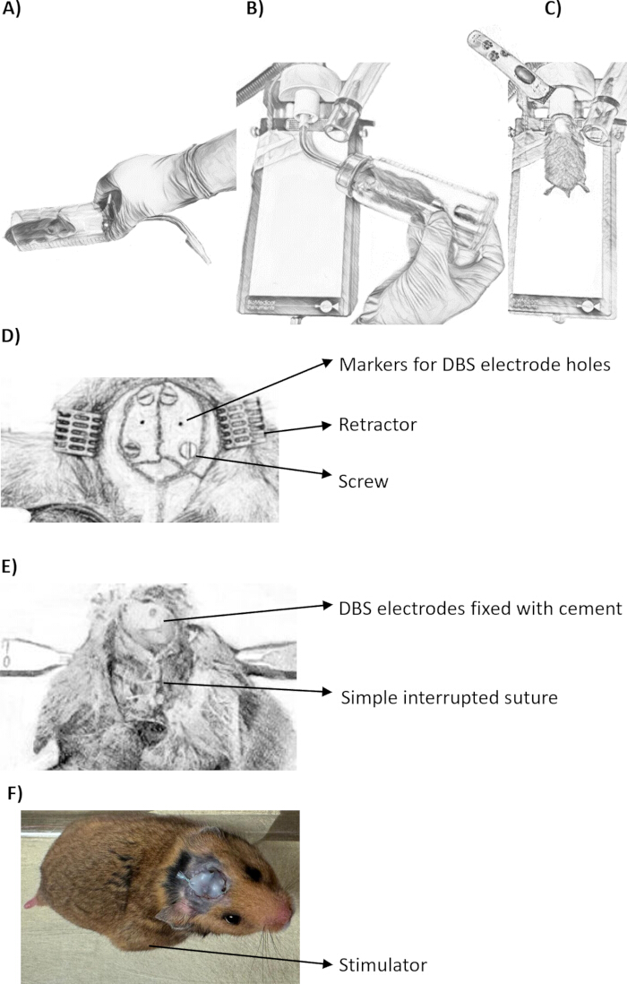 figure-results-2 DBS surgery diagram, electrode placement, fixation with cement, interrupted suture, rat model.