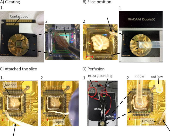figure-results-4 Brain slice electrophysiology setup; clearing, positioning, attachment, perfusion process diagram.