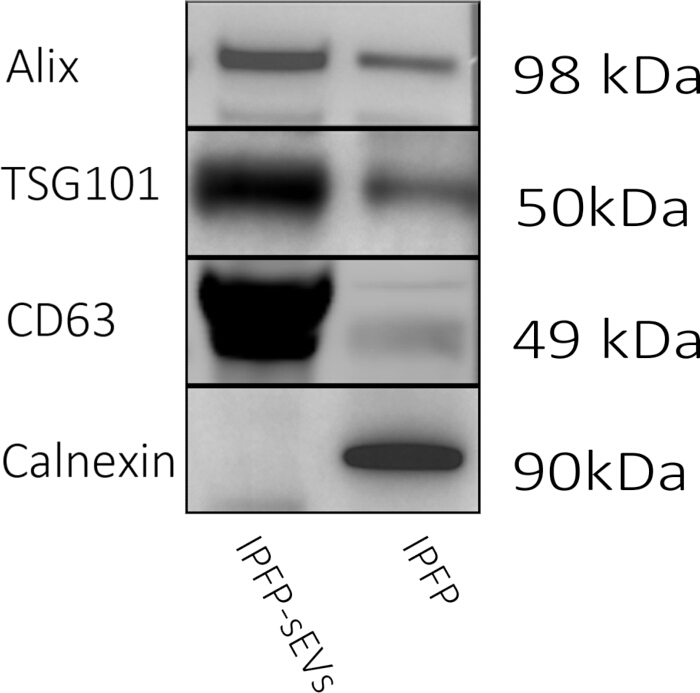 figure-results-3 用于分析Alix、TSG101、CD63和Calnexin蛋白的蛋白质印迹图;分子量。