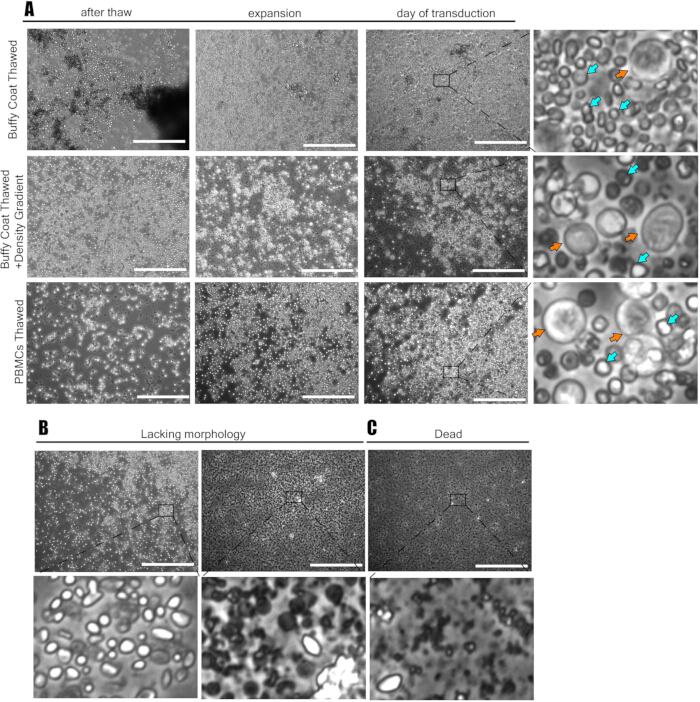 figure-results-2 Cell morphology diagram; microscopic images of PBMC culture, thawing, expansion, transduction stages.