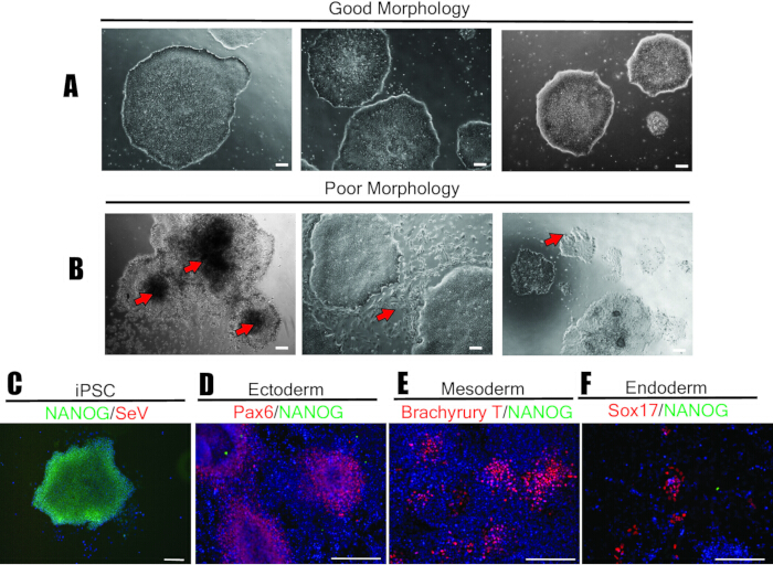 figure-results-4 Stem cell differentiation; morphology study, immunofluorescence; iPSC, ectoderm, mesoderm, endoderm.