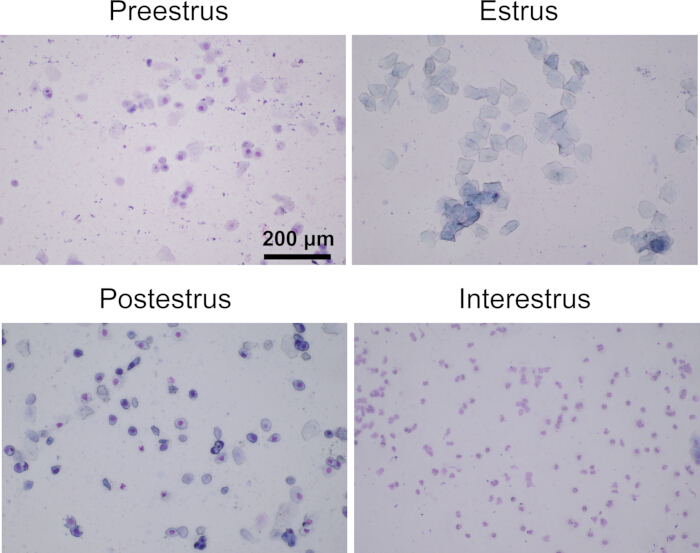 Microscope images of reproductive cycle stages: preestrus, estrus, postestrus, interestrus analysis.