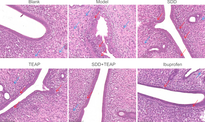Histological analysis, inflammation reduction. Microscope images, tissue sections, treatment effects.