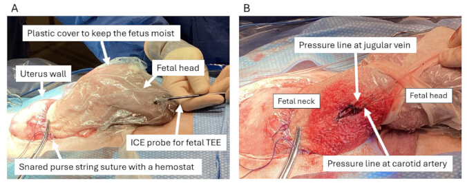 figure-results-1 Fetal TEE procedure with ICE probe, showing surgical setup and labeled anatomical points.