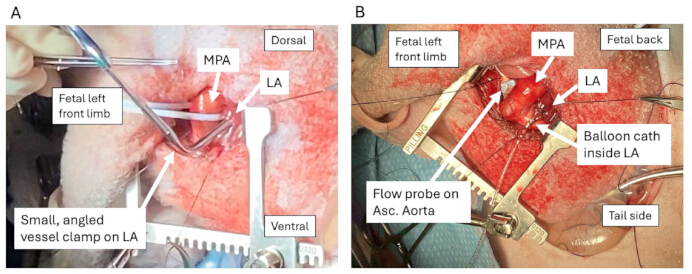 figure-results-2 Fetal surgery setup showing vessel clamp, flow probe, balloon catheter in LA; medical procedure.