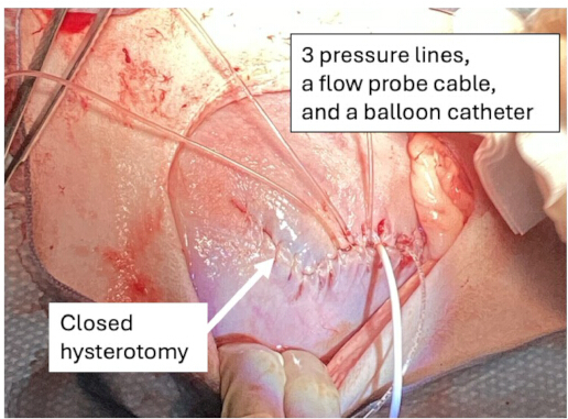 figure-results-4 Surgical setup with closed hysterotomy, pressure lines, flow probe cable, and balloon catheter.