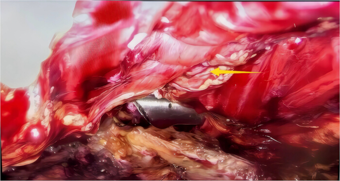 Surgical dissection diagram highlighting tissue structure and tool placement in veterinary procedure.