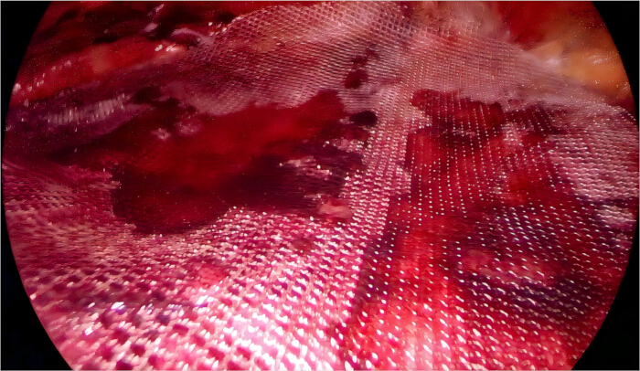 Microscopic image, tissue structure, fiber mesh detail in biomedical material analysis.