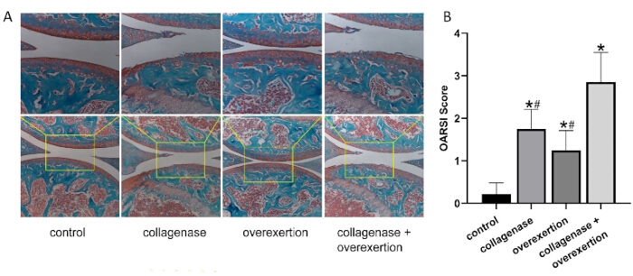 Histological analysis and OARSI scoring of cartilage under control, collagenase, and overexertion.