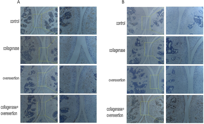 Histological comparison in microscopy images; control, collagenase, overexertion, dual treatment.