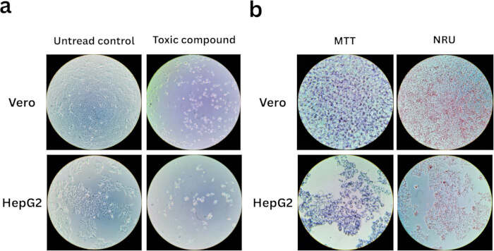 Cell viability assay results; Vero, HepG2 cells, toxic compound; MTT, NRU methods, comparison chart.