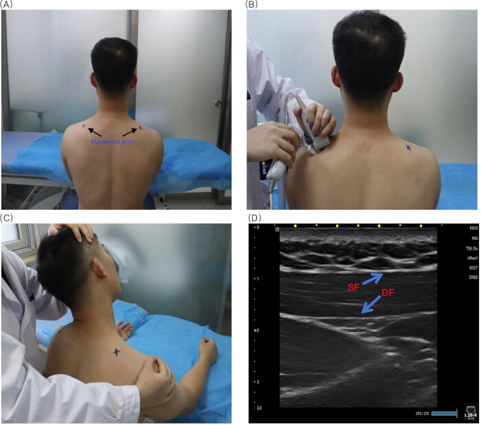 figure-results-2 Ultrasound process on shoulder; diagram shows probe application and muscle tissue analysis results.