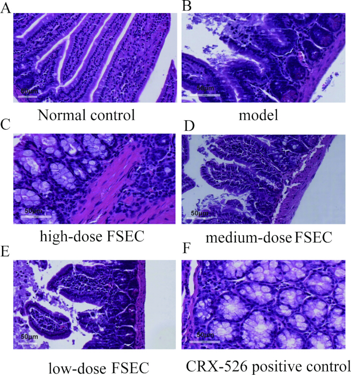 figure-results-1 Colonic tissue histology comparison; includes normal, model, FSEC doses, and CRX-526 control slides.