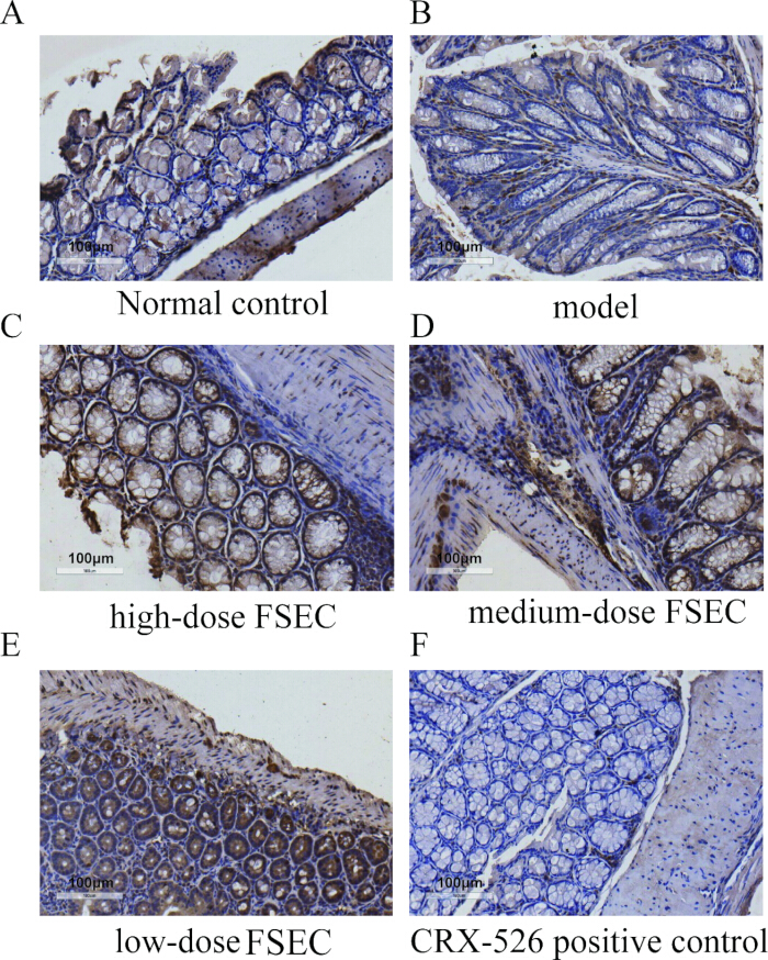 figure-results-2 Histology comparison of intestinal tissues; diagrams show control, model, and varying doses of FSEC.