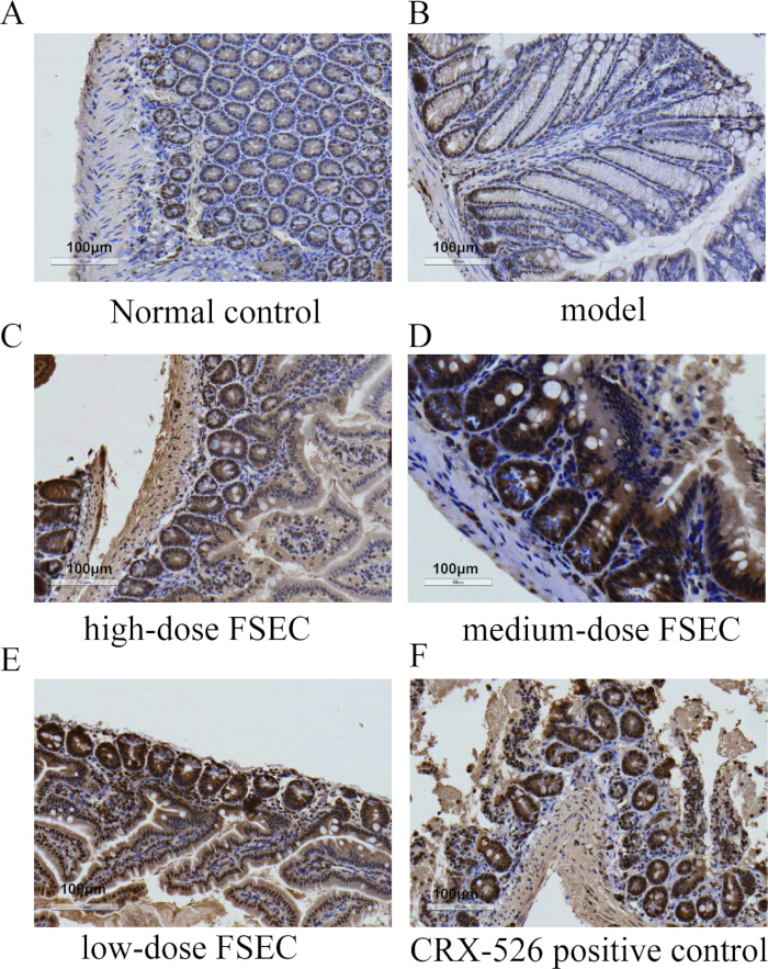 figure-results-3 Histology images of intestinal tissue; control, model, doses of FSEC, CRX-526, 100µm scale.