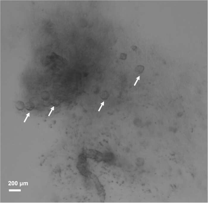 Microscope image showing cell cluster; scale bar: 200μm; potential cell movement direction.