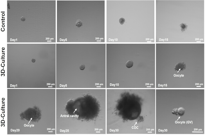 3D-culture oocyte development microscopy images; control vs. experiment; antral cavity formation.