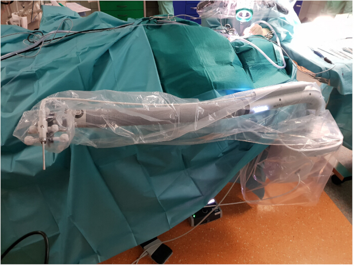 Surgical robot Arm setup in operating room; medical equipment for minimally invasive procedures.