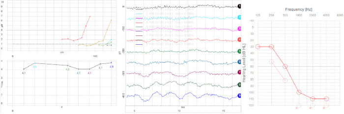 Experimental data graphs showing frequency response and signal analysis.