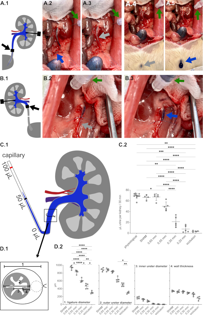 Kidney surgery process; diagrams, surgical photos, urine volume chart, ureter measurements graph.