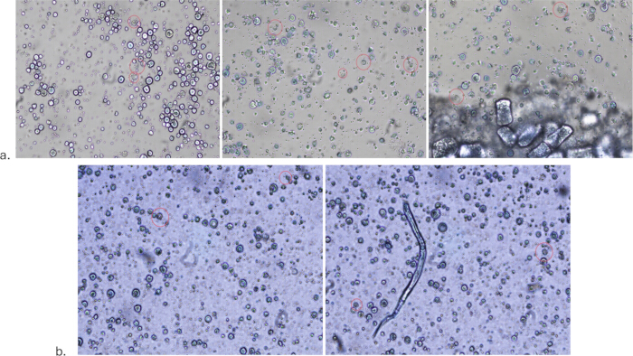 figure-results-5 Microscopic image of parasitic examination showing various stages of nematodes in sample analysis.