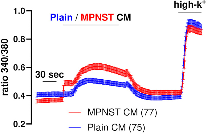 Graph comparing MPNST and Plain CM over 30 seconds, showing 340/380 ratio changes with high potassium.