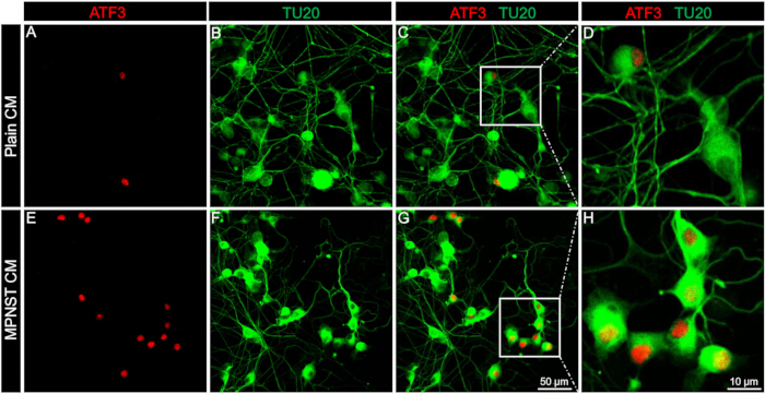 Fluorescence microscopy of nerve cells with ATF3, TU20 markers, analyzing cellular response; diagrams.