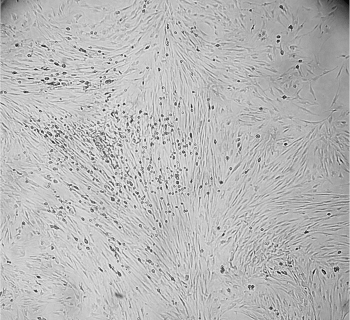Cell culture microscopy image showing fibroblast cells distribution in vitro for biological research.