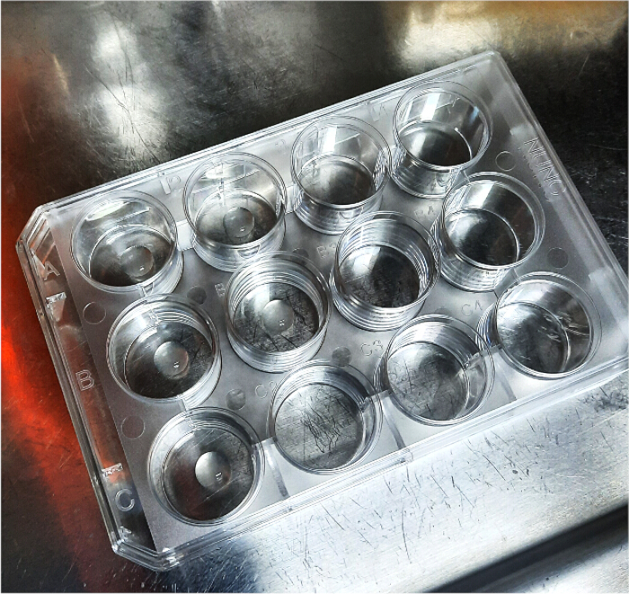 Tissue culture multiwell plate setup for cell growth in vitro experiment.