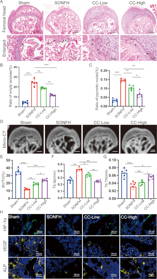 figure-results-11 Femoral head damage analysis; histological, micro-CT, and immunofluorescence results for SONFH.