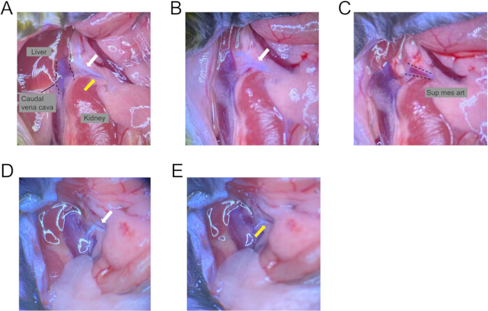 figure-results-1 Dissection study diagram; liver, kidney, caudal vena cava labeled; anatomical experiment results.