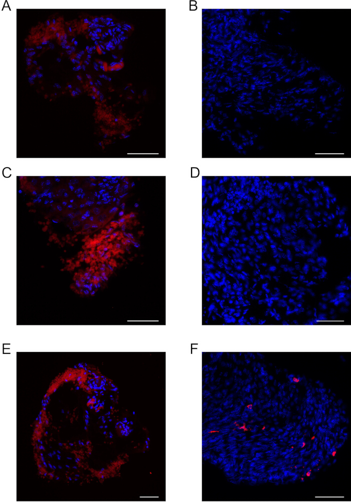 figure-results-3 Fluorescence microscopy images; cell nuclei in blue, cytoplasm in red; cellular structure study.