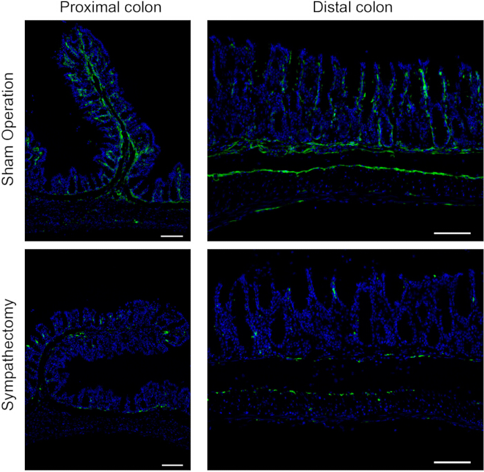 figure-results-4 Colon histology, proximal/distal comparison after sham operation, sympathectomy, fluorescence microscopy.