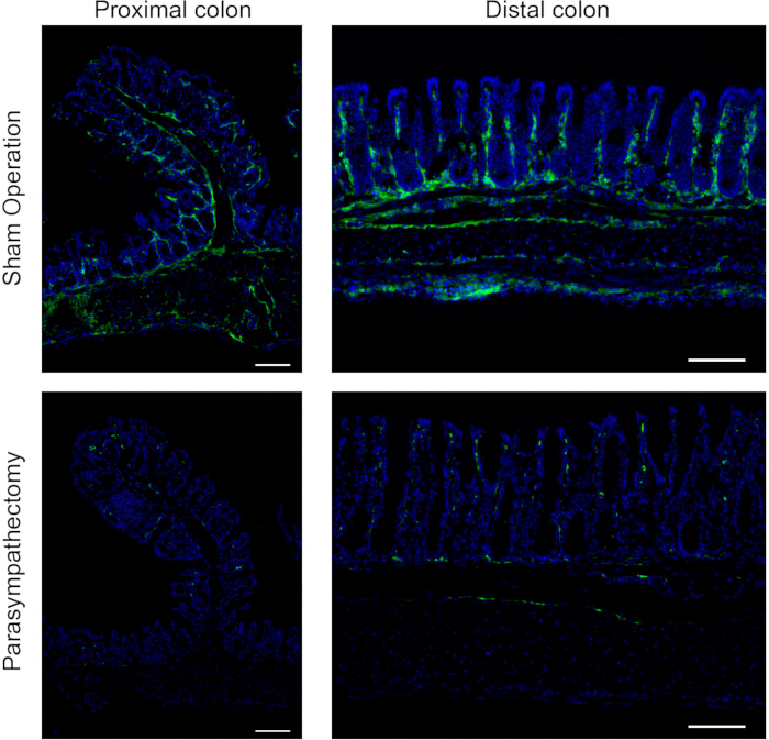 figure-results-5 Proximal and distal colon microscopy images; sham operation vs. parasympathectomy; colonic tissue.