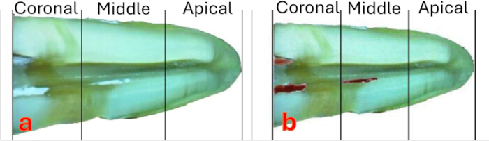 Tooth section analysis; labeled coronal, middle, apical segments; diagram comparison showing results.