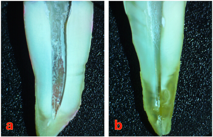 Tooth cross-section microscopy images showing dentin structure comparison; experiment result.