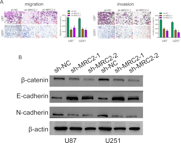 figure-results-7 Cell migration and invasion assays with bar graphs, Western blot protein analysis; β-catenin, cadherins.
