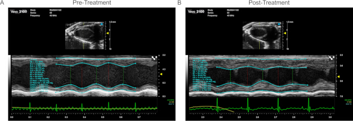 figure-results-2 Ultrasound heart analysis; pre/post-treatment; echocardiography images and graphs; cardiac function comparison.