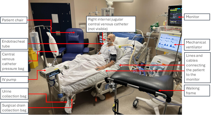 Hospital room setup with patient on ventilator, catheter system, IV pump, monitor, and accessories.